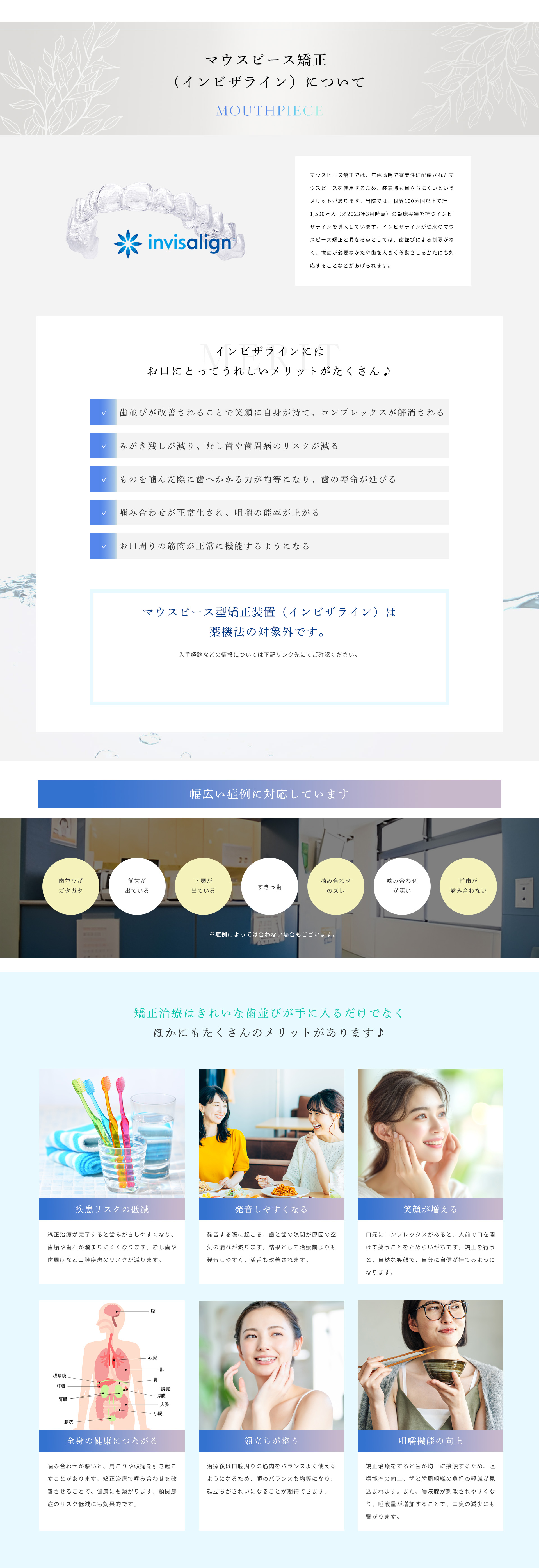 マウスピース矯正（インビザライン）について